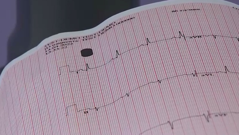 Неделя осведомлённости о заболеваниях сердца стартовала в Петербурге