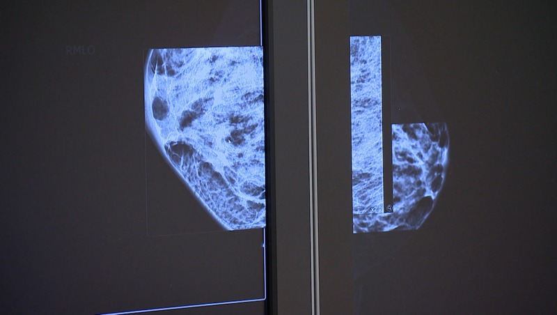 Александр Беглов поручил заменить маммограф в поликлинике на улице Асафьева