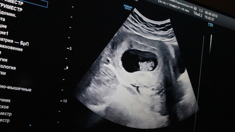 Волынец: закон о запрете пропаганды чайлдфри никого не обязывает рожать