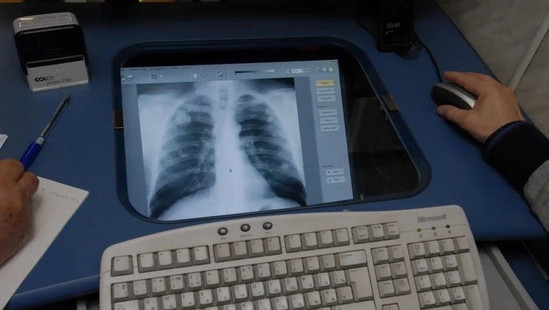 5 больниц Свердловской области внедрят ИИ для диагностики пациентов при поддержке Сбера