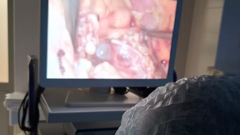 В Елабужской ЦРБ освоили высокотехнологичные операции по удалению кист почек